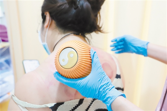 醫(yī)護人員在夜間門診為患者拔火罐。 醫(yī)護人員在夜間門診為患者拔火罐。