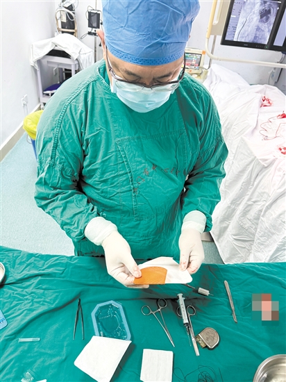 醫(yī)生在準(zhǔn)備TYRX可吸收抗菌封套。